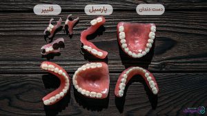 قیمت دندان مصنوعی