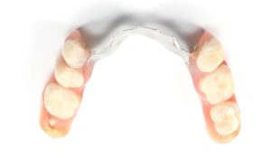 مراحل ساخت دندان مصنوعی چیست؟