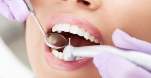 عوارض پر كردن دندان شامل چه مواردی است