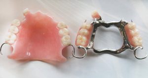 دندان مصنوعی تکه ای یکی از انواع دندان مصنوعی متحرک است.