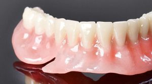 دندان مصنوعی متحرک چگونه تولید می‌شود