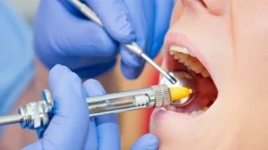 عوارض بی حسی دندان