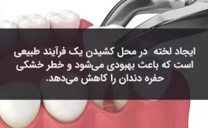 جلوگیری از تشکیل حفره خشک یکی از راه‌های مراقبت بعد از کشیدن دندان است.