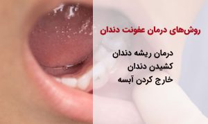 روش‌های درمان عفونت دندان شامل درمان ریشه و کشیدن و درمان آبسه است.