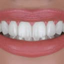 زیبایی دندان