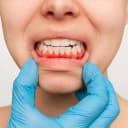 بیماریهای لثه و استخوان