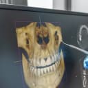 CBCT (تصویر سه‌بعدی فک و دندان)