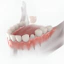 روکش Zirconia