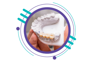 مراحل ایمپلنت دندان - قالب گیری و نصب اباتمنت ایمپلنت
