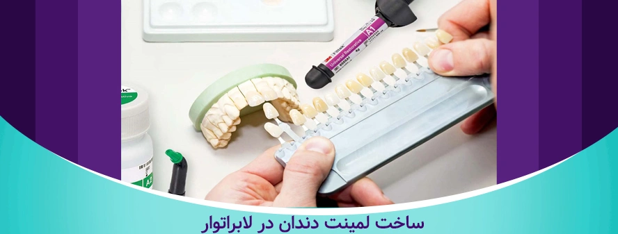 مراحل لمینت دندان - ساخت لمینت در لابراتوار