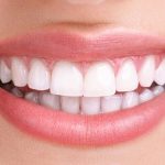 مرتب کردن دندان ها و صاف کردن بدون ارتودنسی با ۲ روش