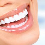 بلیچینگ دندان چیست و چگونه انجام می‌شود؟