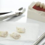چرا انجام جراحی دندان عقل ضروری است؟