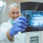 رادیولوژی دندان یا رادیوگرافی دندان چیست؟