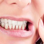 دندان قروچه چیست؟ + علت دندان قروچه