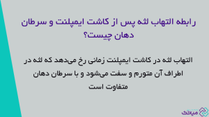 آیا ایمپلنت باعث سرطان میشود