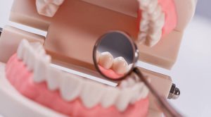 علائم عفونت بعد از کشیدن دندان عقل