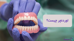 اوردنچر
