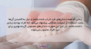 دندان مصنوعی