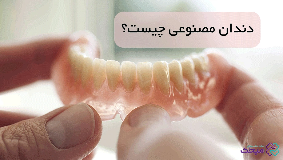 دندان مصنوعی چیست؟