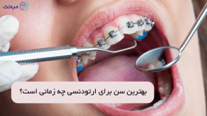 بهترین سن برای ارتودنسی