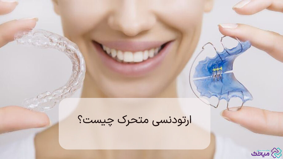 ارتودنسی متحرک