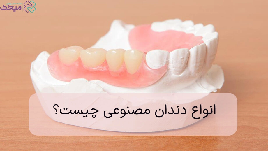انواع دندان مصنوعی کدام است