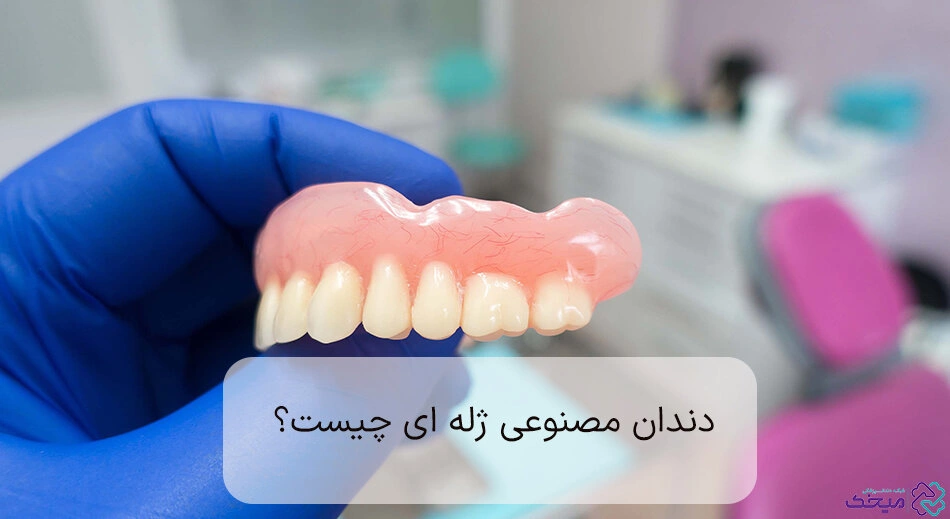 دندان مصنوعی ژله ای چیست