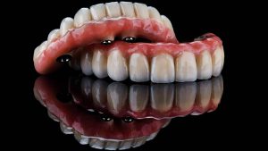 دندان مصنوعی ثابت چیست