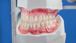 دندان مصنوعی متحرک چیست