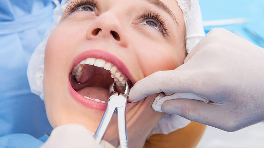 مراقبت بعد از کشیدن دندان