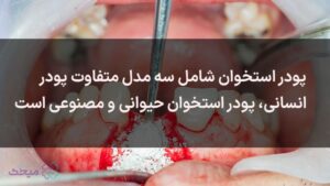 پودر استخوان برای جراحی ایمپلنت استفاده می‌شود.
