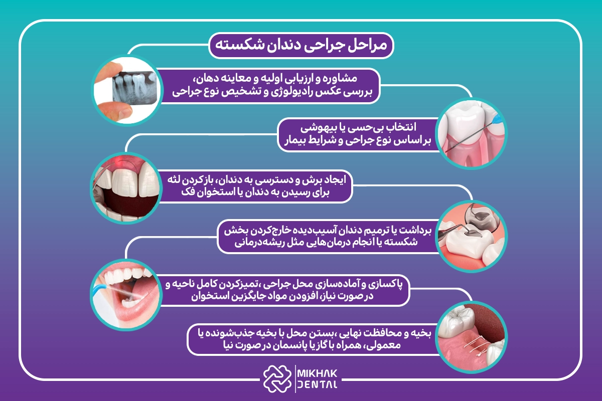 مراحل جراحی دندان شکسته
