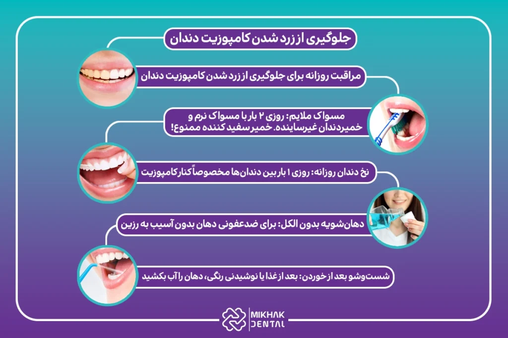 پیشگیری از زرد شدن کامپوزیت دندان