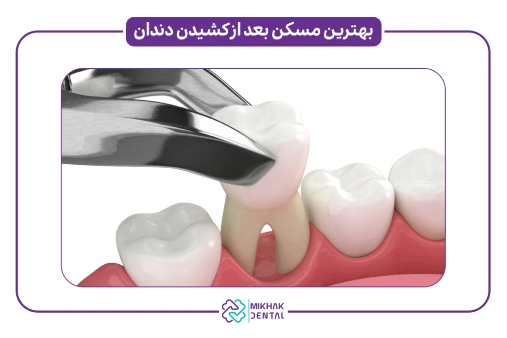 مسکن مجاز بعد از جراحی دندان برای افراد حساس