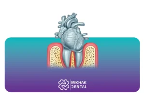 تاثیر عصب کشی دندان بر قلب