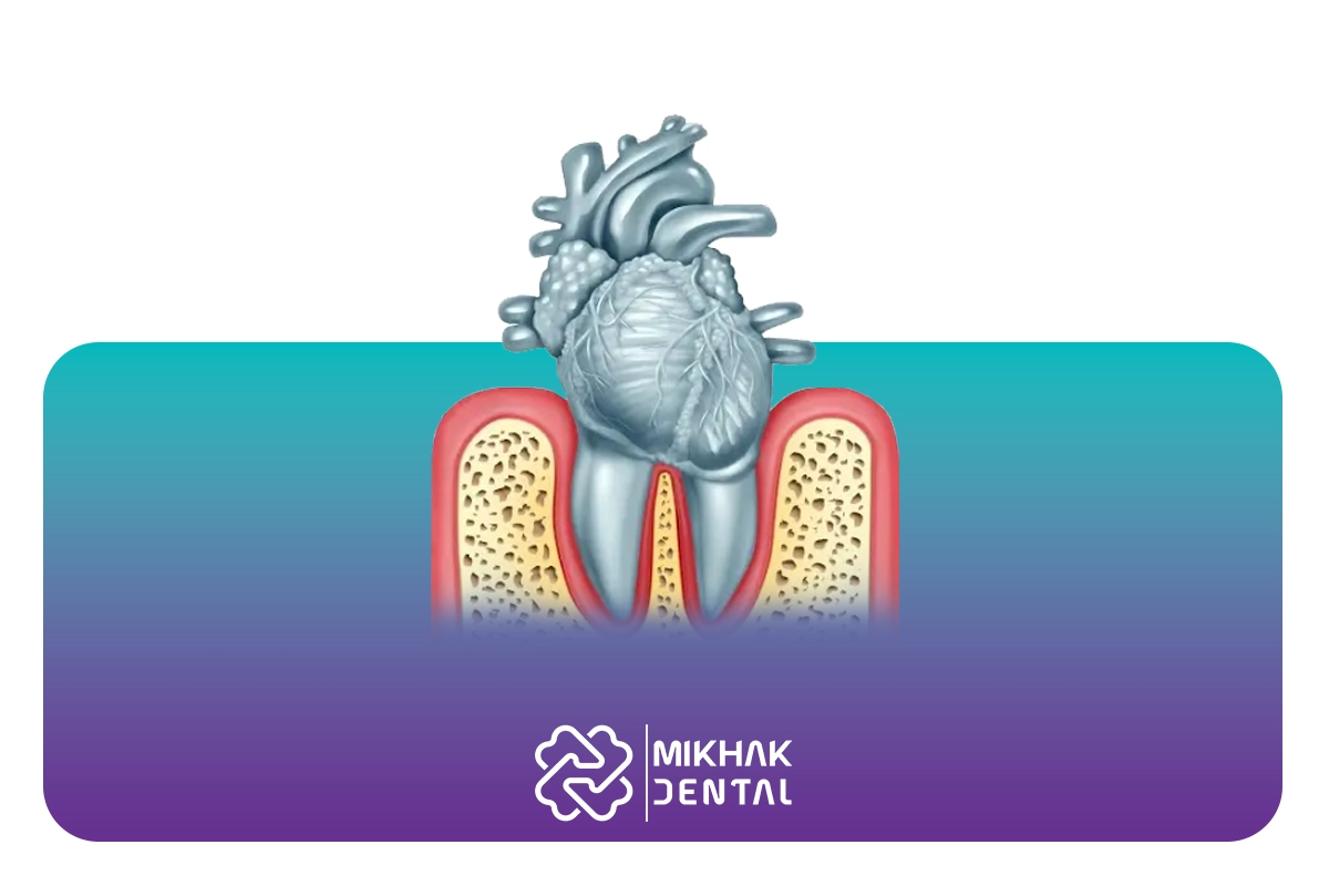 تاثیر عصب کشی دندان بر قلب