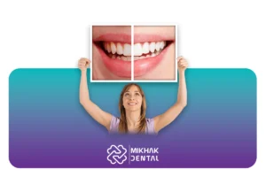 بلیچینگ دندان در بارداری