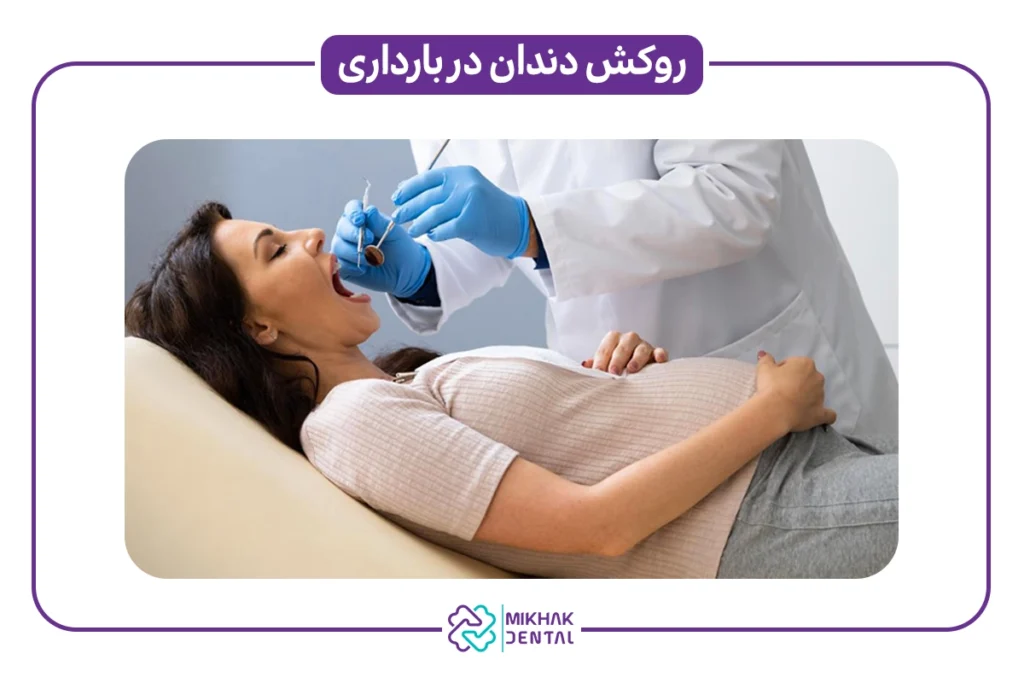 عوارض روکش دندان در بارداری