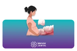 روکش دندان در بارداری