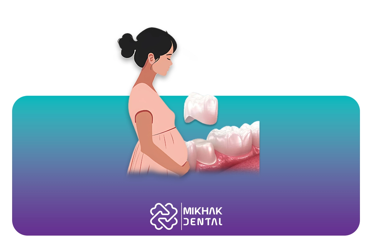 روکش دندان در بارداری